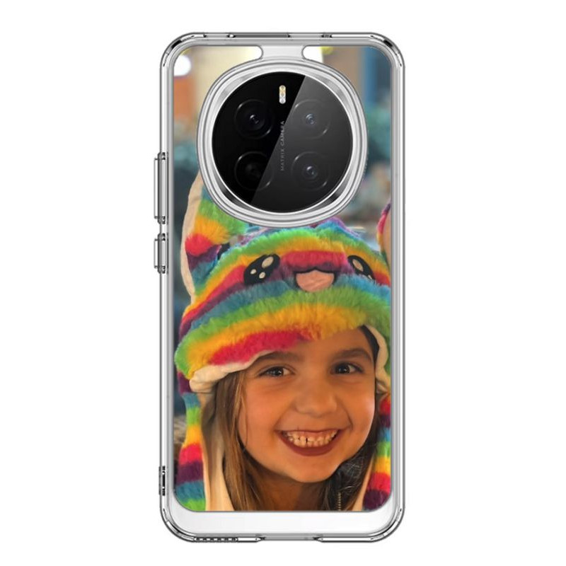 Coque Honor Magic 7 Pro personnalisable