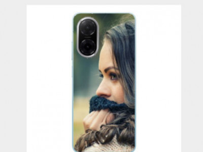 Personnalisez votre Xiaomi Redmi A5 avec nos accessoires uniques
